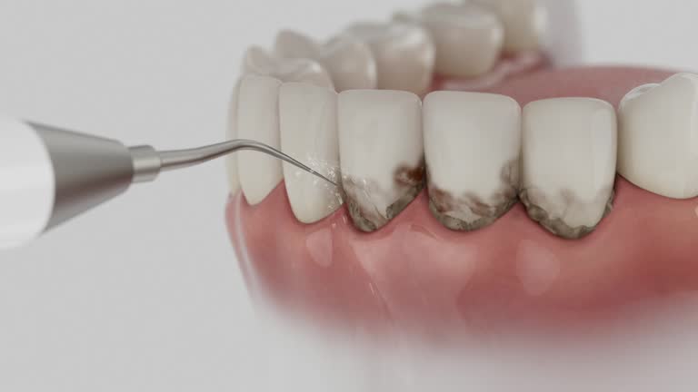 Reliable Wisdom Tooth Removal contractor in Hancock County County, OH by Dentist Open Now